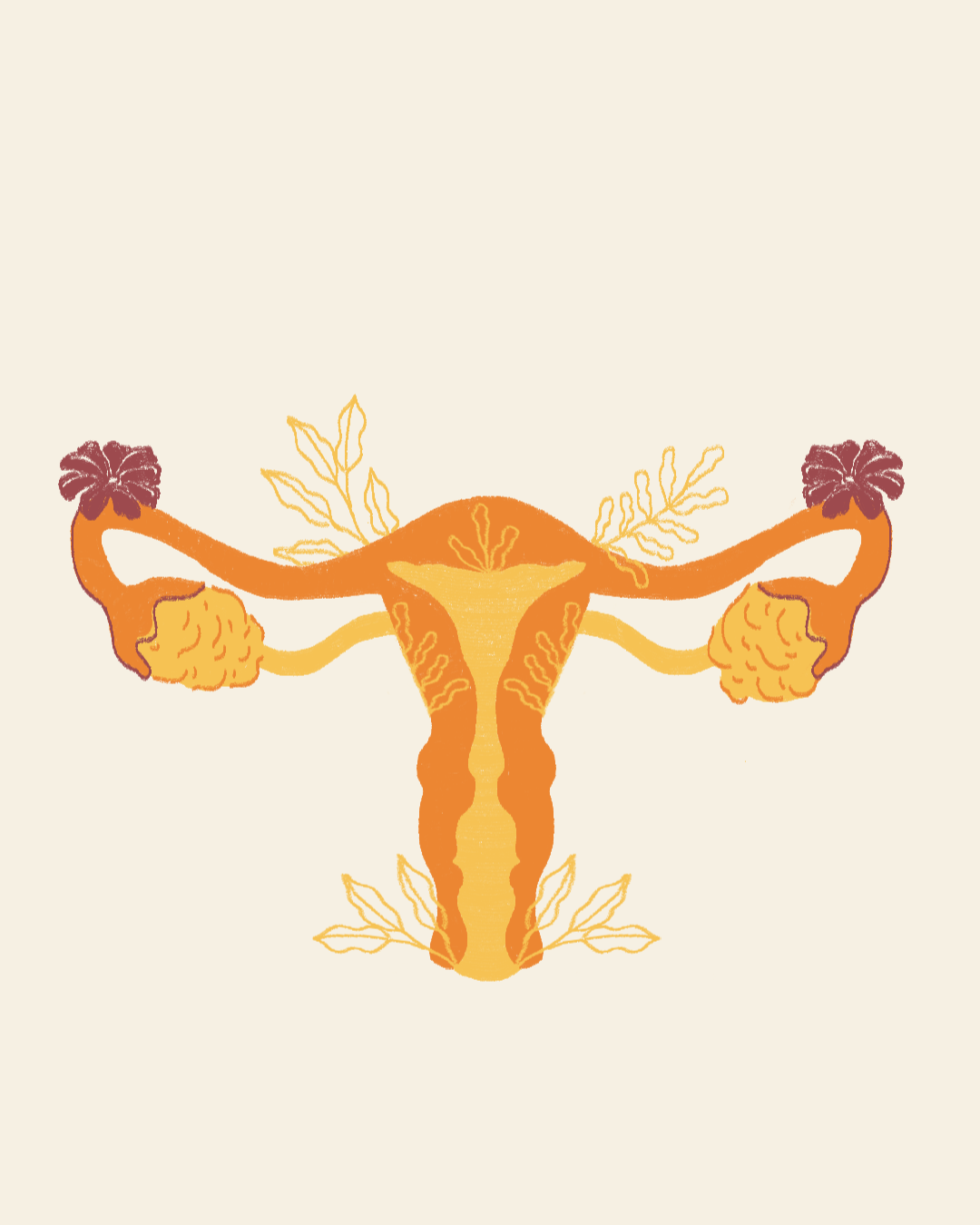 Endometriosis: Cuando el endometrio se convierte en un desafío para la salud menstrual